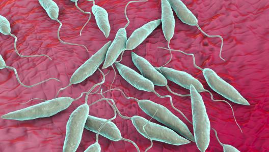 leishmaniasis